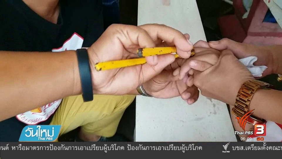 เตือนภัยแหวนแถมขนมเด็กสวมติดนิ้ว