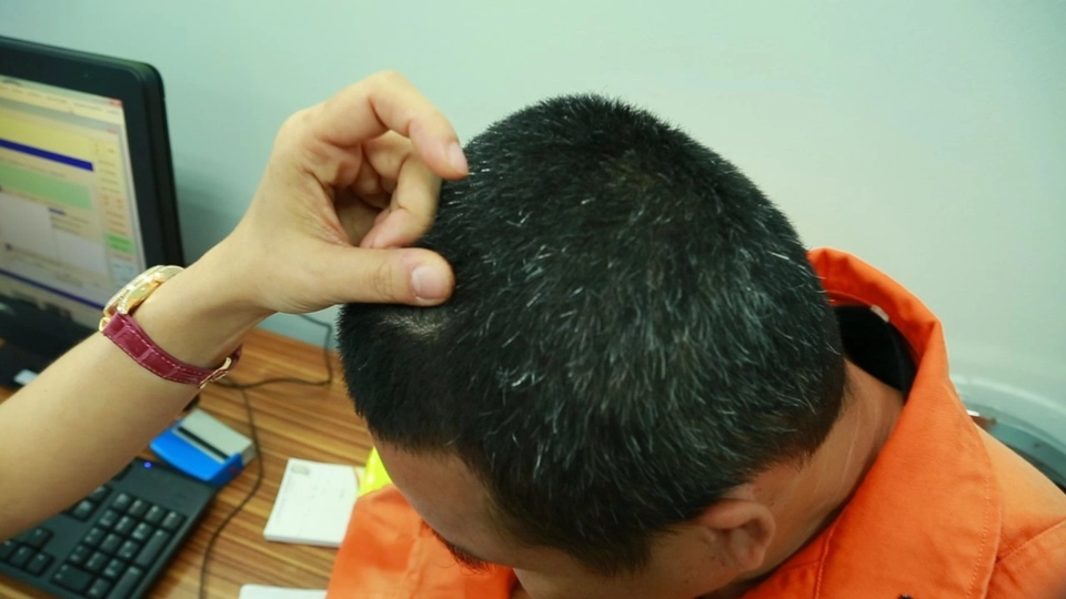 รู้สู้โรค : แก้ไขหนังศีรษะแห้ง และรังแค