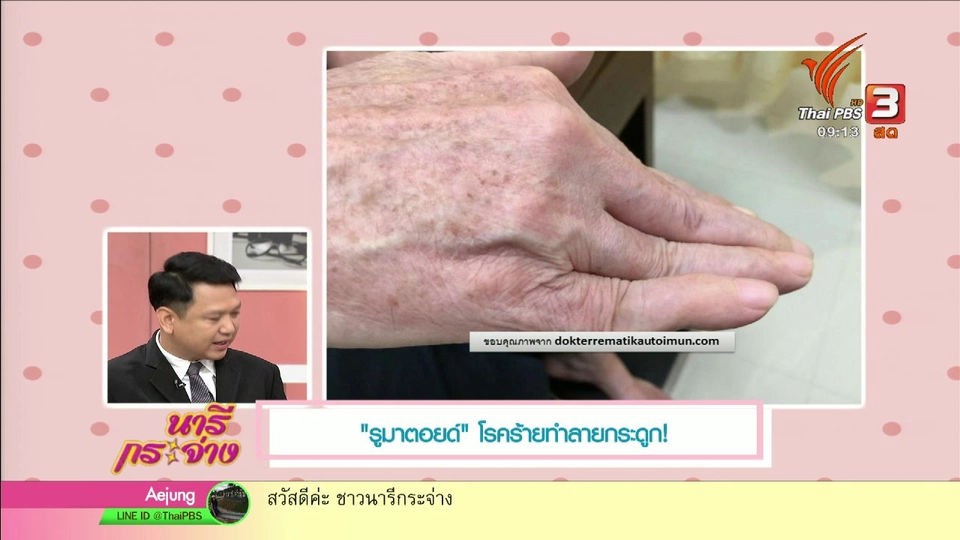 นารีสนทนา : "รูมาตอยด์" ทำลายกระดูกจริงหรือ?
