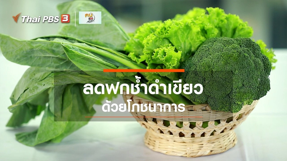 รู้สู้โรค : ลดอาการฟกช้ำดำเขียวด้วยโภชนาการ