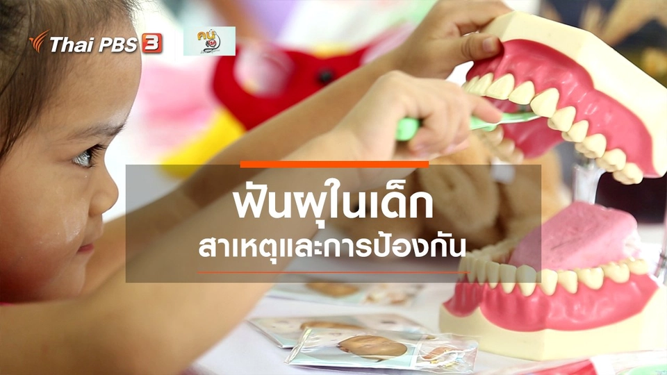 ​รู้สู้โรค : ฟันผุในเด็ก