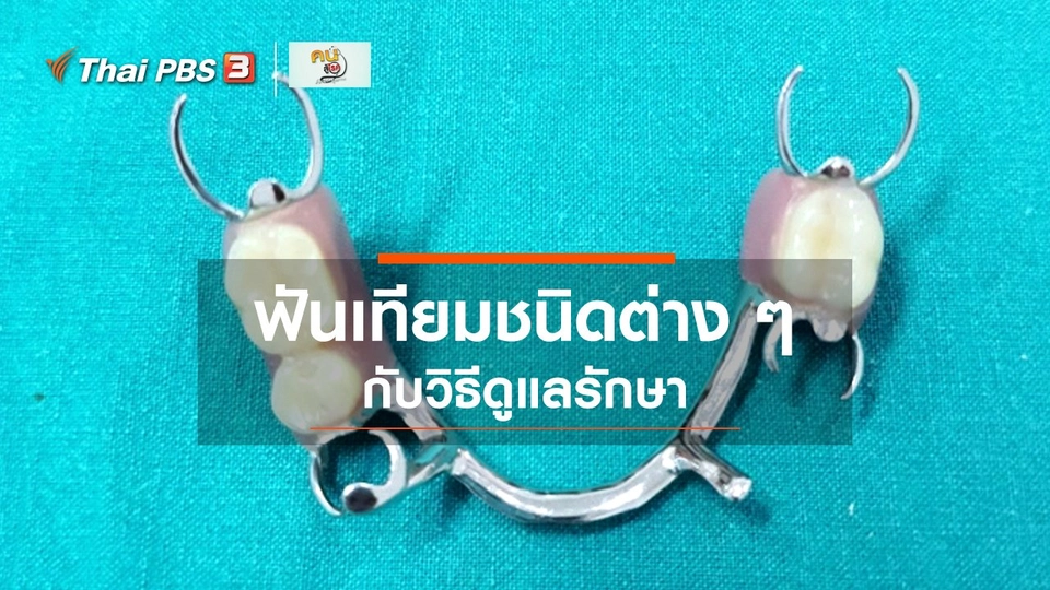 รู้สู้โรค : ฟันเทียมชนิดต่าง ๆ