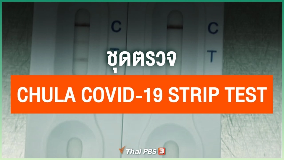 ชุดตรวจ Chula COVID-19 Strip Test