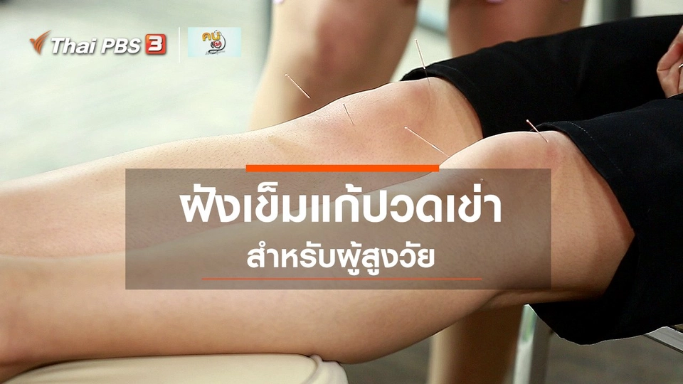 ปรับก่อนป่วย : ฝังเข็มแก้ปวดเข่า