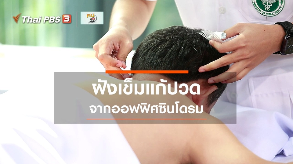 ปรับก่อนป่วย : ฝังเข็มแก้ปวดจากออฟฟิศซินโดรม