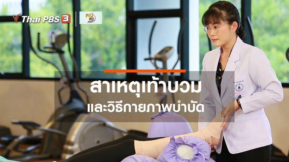 บำบัดง่าย ๆ ด้วยกายภาพ : อย่ามองข้ามอาการเท้าบวม
