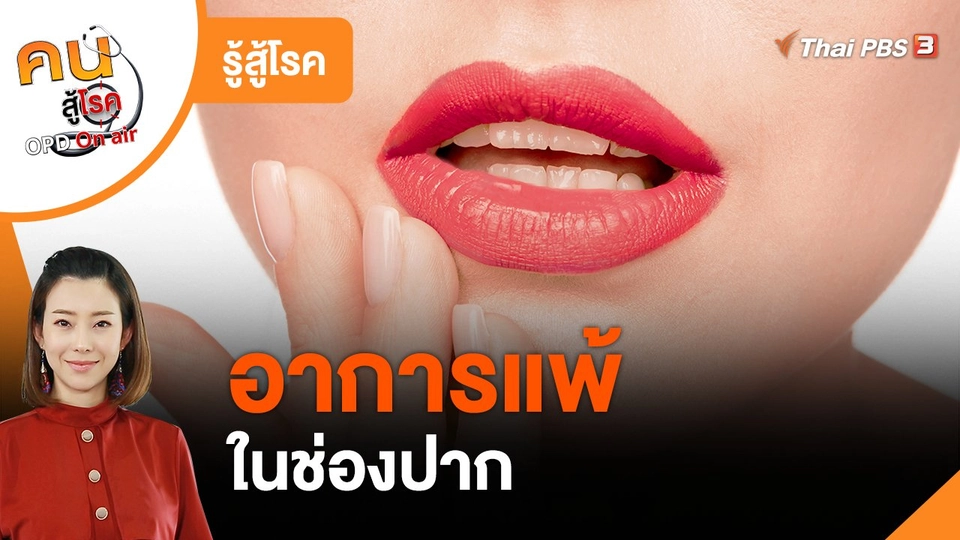 รู้สู้โรค : อาการแพ้ในช่องปาก
