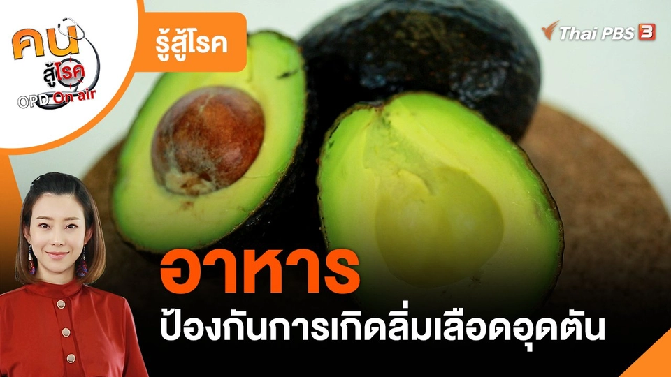 ​รู้สู้โรค : อาหารป้องกันการเกิดลิ่มเลือดอุดตัน