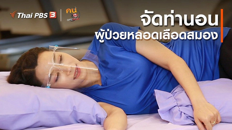 บำบัดง่าย ๆ ด้วยกายภาพ : จัดท่านอนเหมาะต่อผู้ป่วยหลอดเลือดสมอง