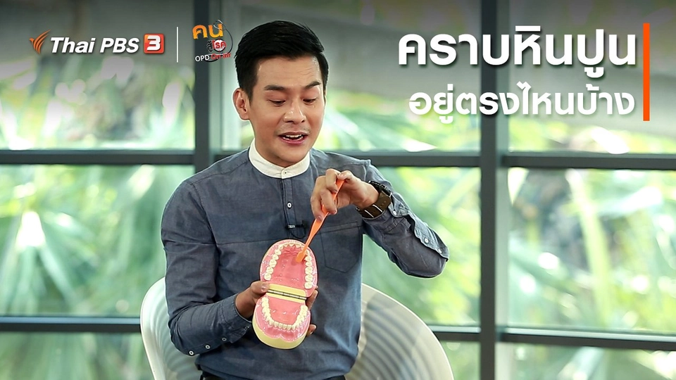 ​รู้สู้โรค : คราบหินปูน อยู่ตรงไหนบ้าง