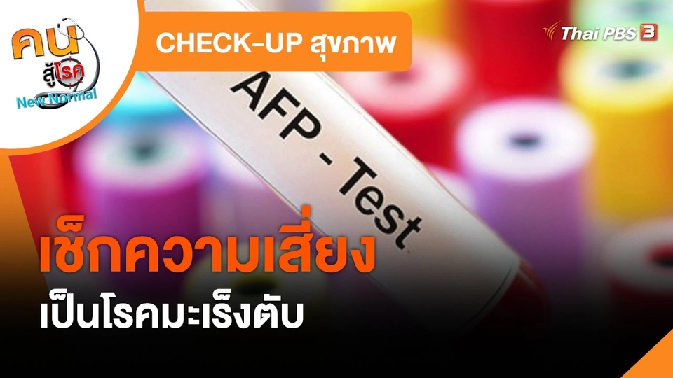 ​CHECK-UP สุขภาพ : เช็กความเสี่ยงเป็นโรคมะเร็งตับ