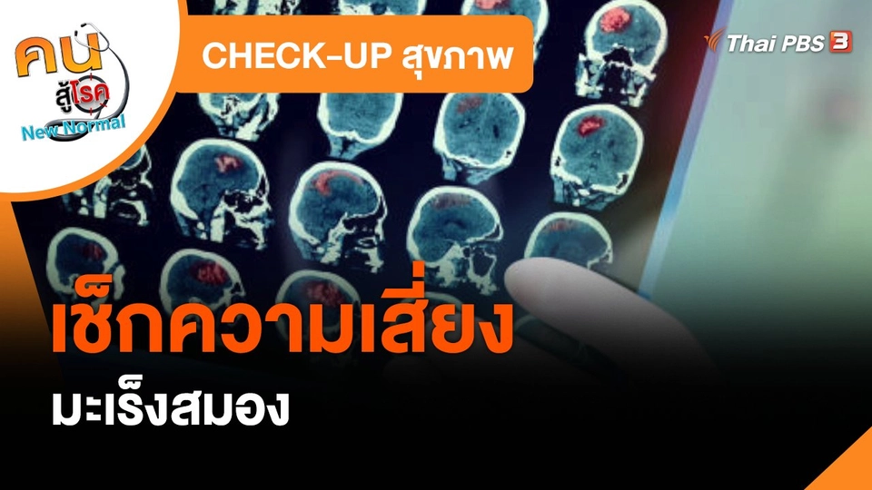 ​CHECK-UP สุขภาพ : เช็กความเสี่ยงมะเร็งสมอง
