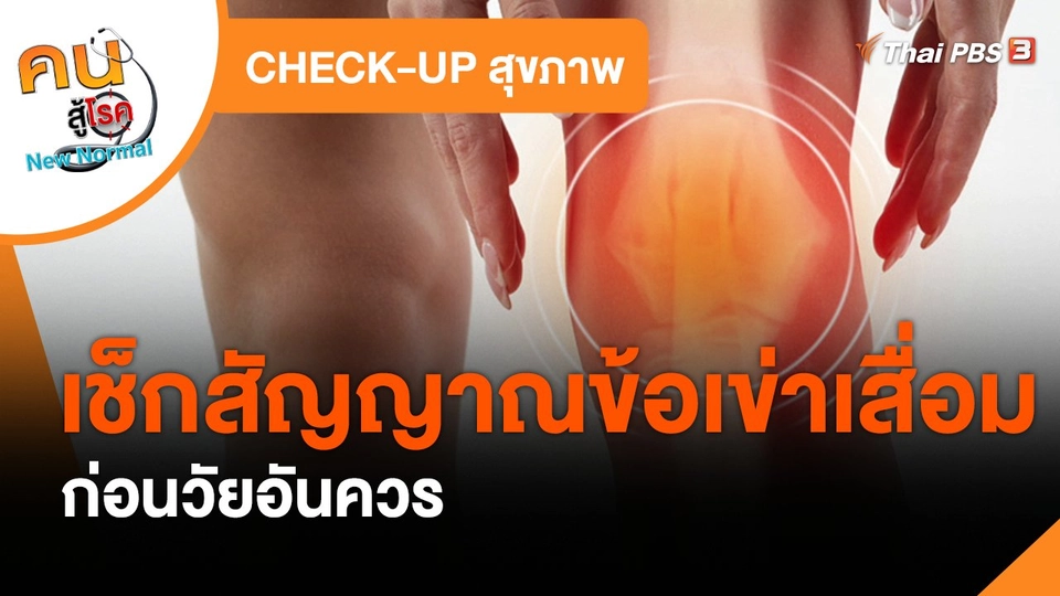 CHECK-UP สุขภาพ : เช็กสัญญาณข้อเข่าเสื่อมก่อนวัยอันควร