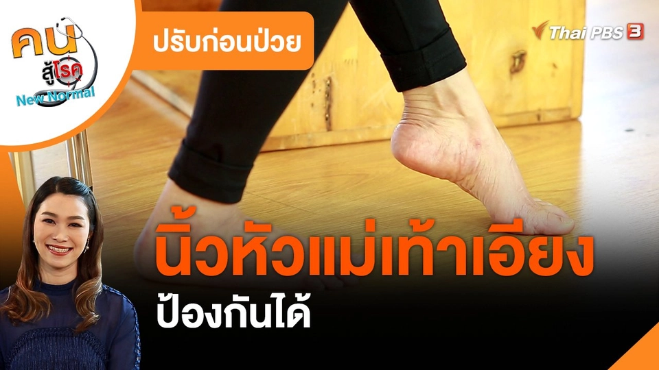ปรับก่อนป่วย : นิ้วหัวแม่เท้าเอียง ป้องกันได้