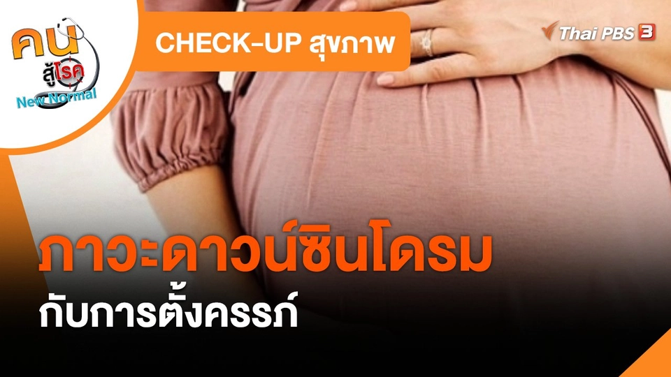 ​CHECK-UP สุขภาพ : ภาวะดาวน์ซินโดรมกับการตั้งครรภ์