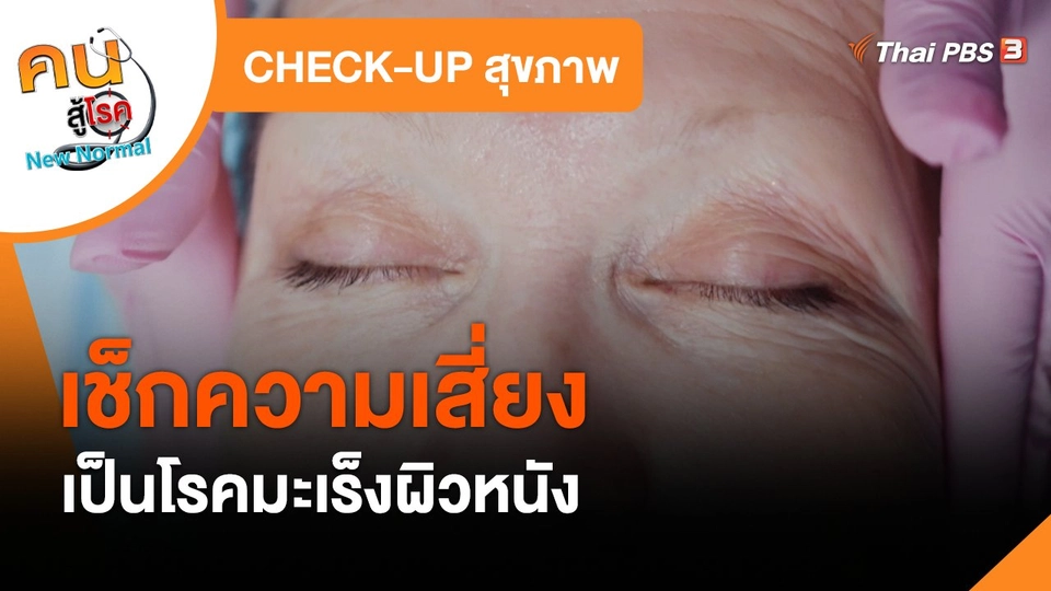 ​CHECK-UP สุขภาพ : เช็กความเสี่ยงเป็นโรคมะเร็งผิวหนัง