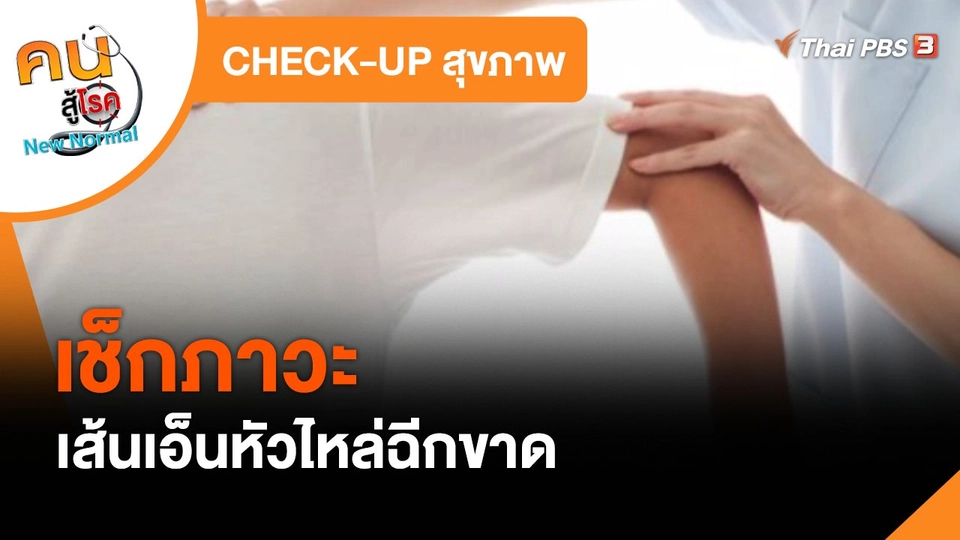 CHECK-UP สุขภาพ : เช็กภาวะเส้นเอ็นหัวไหล่ฉีกขาด