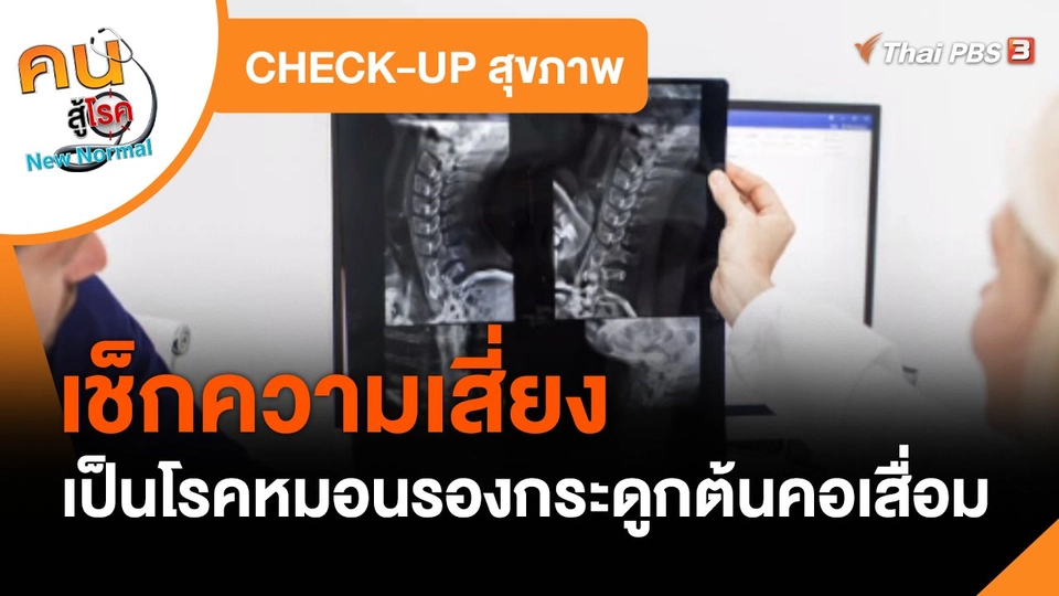 CHECK-UP สุขภาพ : เช็กความเสี่ยงเป็นโรคหมอนรองกระดูกต้นคอเสื่อม