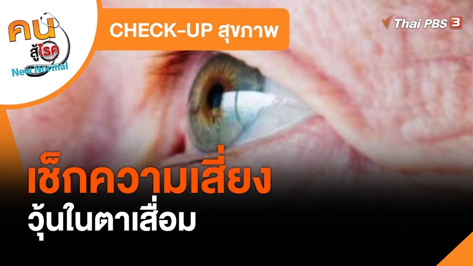 CHECK-UP สุขภาพ : เช็กความเสี่ยงวุ้นในตาเสื่อม
