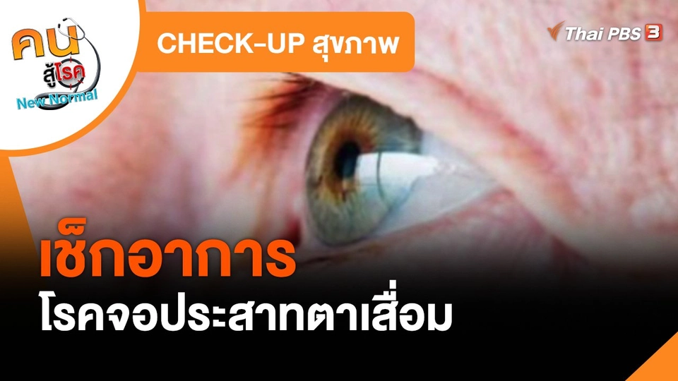 CHECK-UP สุขภาพ : เช็กอาการโรคจอประสาทตาเสื่อม
