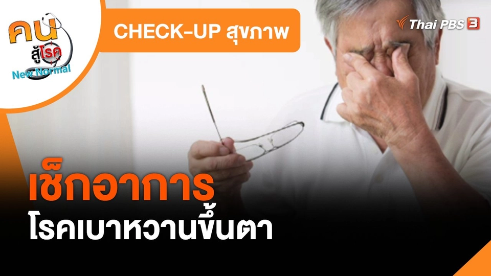 CHECK-UP สุขภาพ : เช็กอาการโรคเบาหวานขึ้นตา