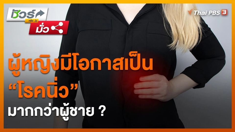 ​ชัวร์หรือมั่ว : ผู้หญิงมีโอกาสเป็น "โรคนิ่ว" มากกว่าผู้ชาย ?