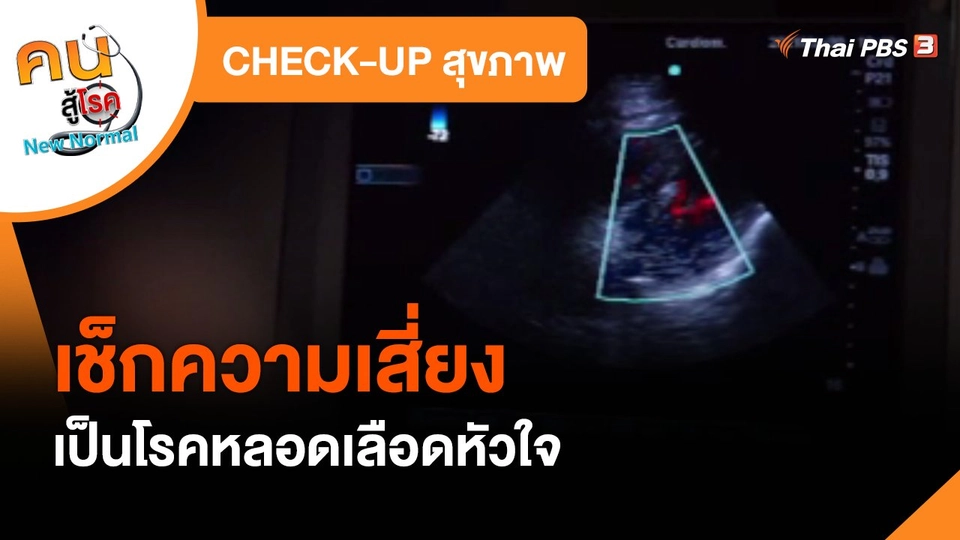 CHECK-UP สุขภาพ : เช็กความเสี่ยงเป็นโรคหลอดเลือดหัวใจ