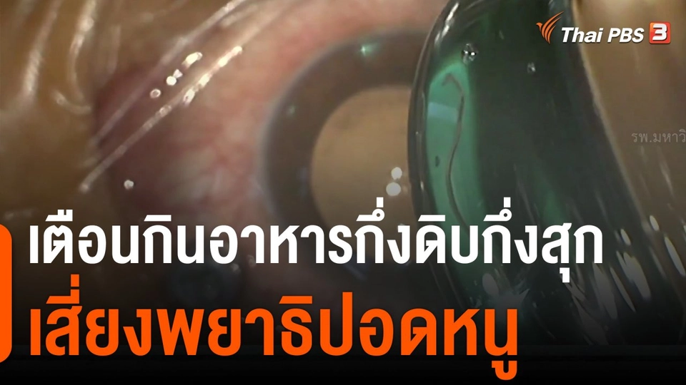 เตือนกินอาหารกึ่งดิบกึ่งสุกเสี่ยงพยาธิปอดหนู