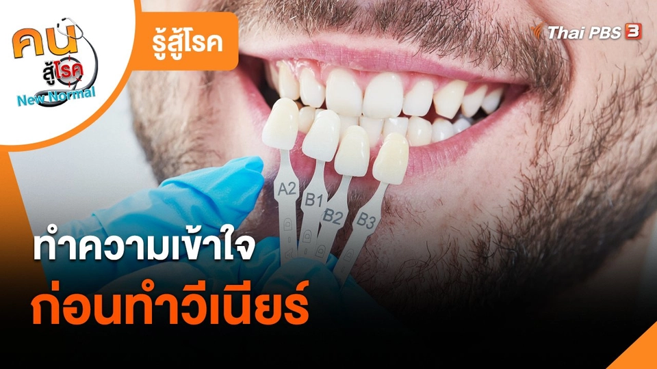 ​รู้สู้โรค : ทำความเข้าใจก่อนทำวีเนียร์