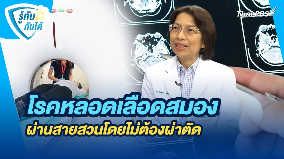 รู้ทันกันได้ : โรคหลอดเลือดสมอง รู้ทันป้องกันอัมพาต