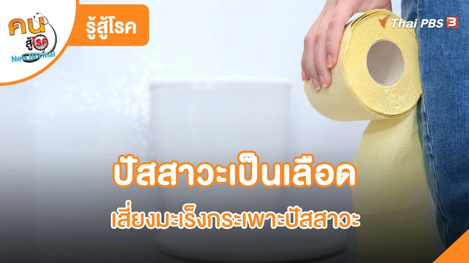 ปัสสาวะเป็นเลือด เสี่ยงมะเร็งกระเพาะปัสสาวะ