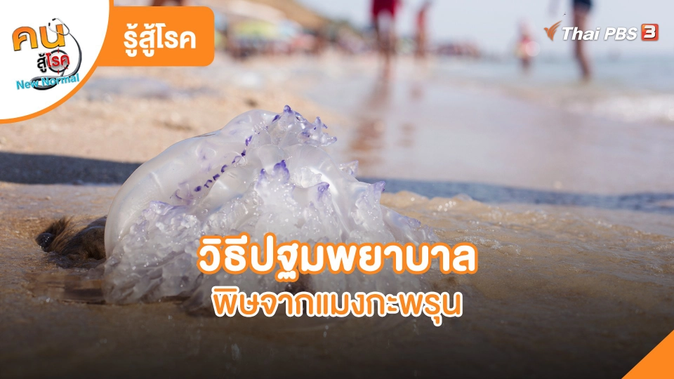​รู้สู้โรค : วิธีปฐมพยาบาลพิษจากแมงกะพรุน