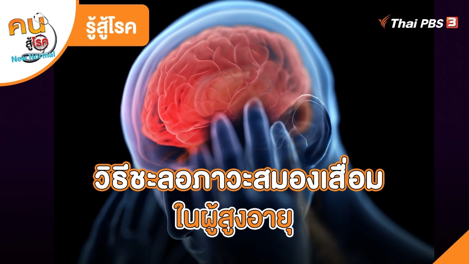 วิธีชะลอภาวะสมองเสื่อมในผู้สูงอายุ