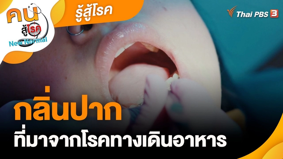​รู้สู้โรค : กลิ่นปากที่มาจากโรคทางเดินอาหาร