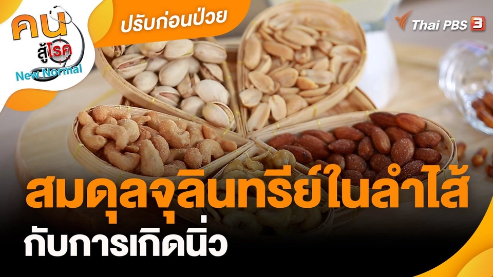 ปรับก่อนป่วย : สมดุลจุลินทรีย์ในลำไส้ กับการเกิดนิ่ว