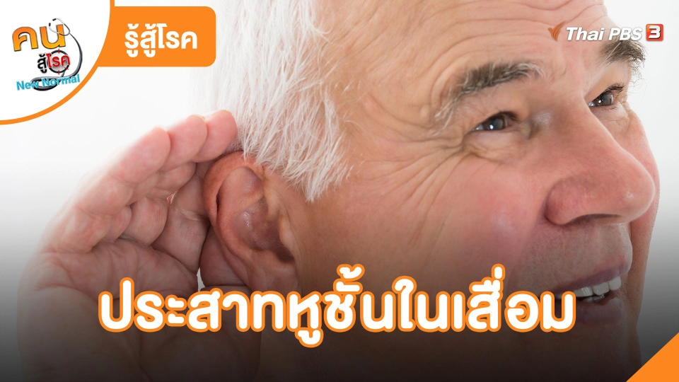ประสาทหูชั้นในเสื่อม