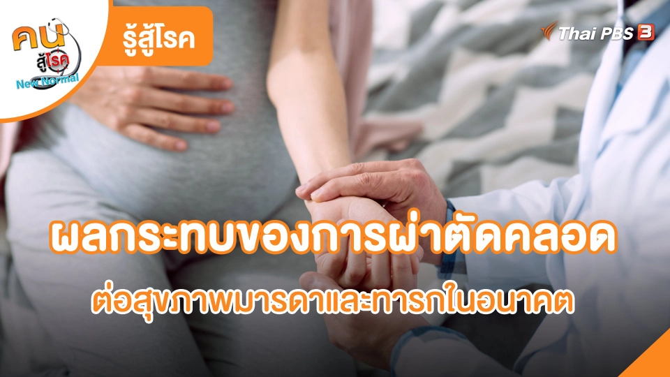 ผลกระทบของการผ่าตัดคลอดต่อสุขภาพมารดาและทารกในอนาคต