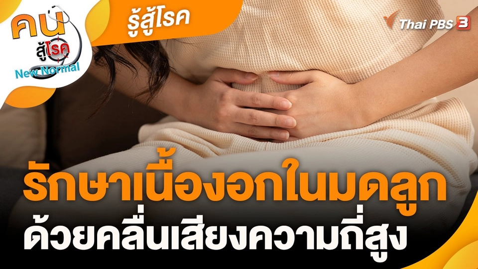 รู้สู้โรค : รักษาเนื้องอกในมดลูก ด้วยคลื่นเสียงความถี่สูง