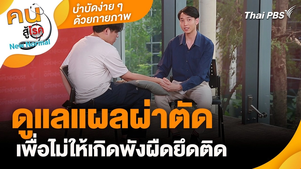 บำบัดง่าย ๆ ด้วยกายภาพ : ดูแลแผลผ่าตัดเพื่อไม่ให้เกิดพังผืดยึดติด