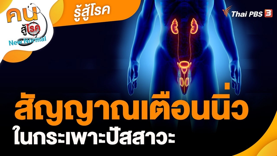 รู้สู้โรค : สัญญาณเตือนนิ่วในกระเพาะปัสสาวะ