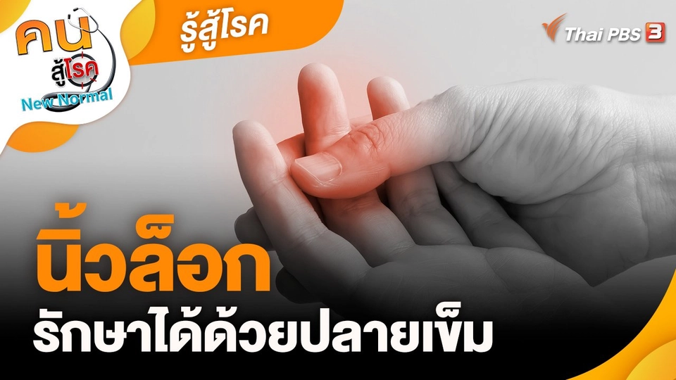​รู้สู้โรค : นิ้วล็อก รักษาได้ด้วยปลายเข็ม
