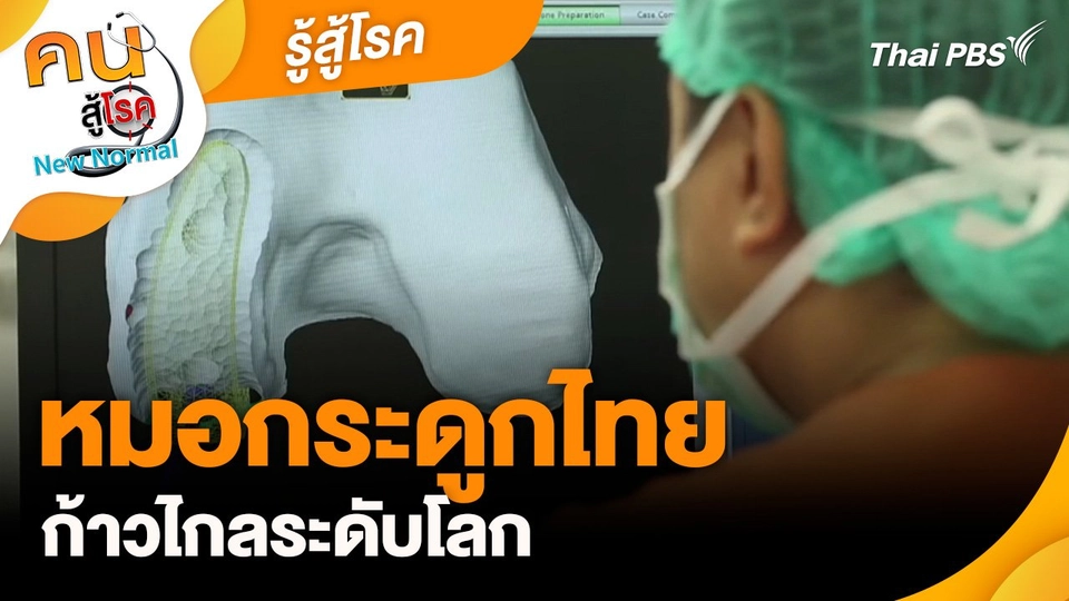 รู้สู้โรค : หมอกระดูกไทยก้าวไกลระดับโลก