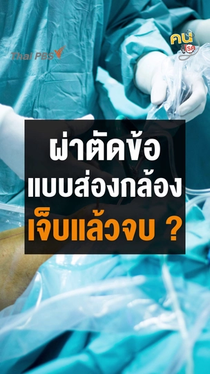 ผ่าตัดข้อแบบส่องกล้อง เจ็บแล้วจบหรือไม่ ?