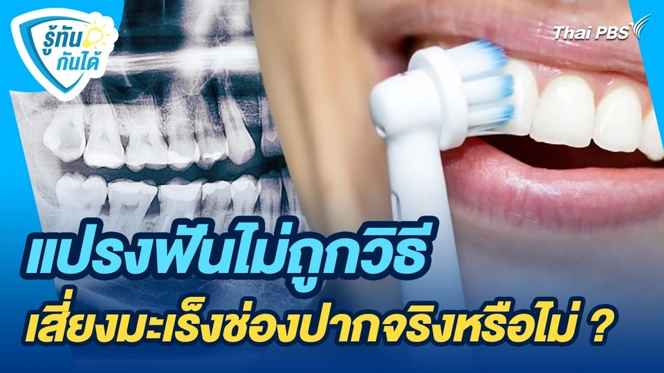 รู้ทันกันได้ : แปรงฟันไม่ถูกวิธีเสี่ยงมะเร็งช่องปากจริงหรือไม่ ?