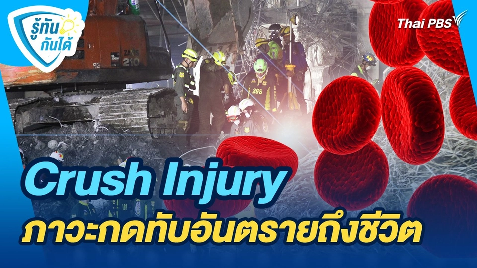 รู้ทันกันได้ : Crush Injury ภาวะกดทับอันตรายถึงชีวิต