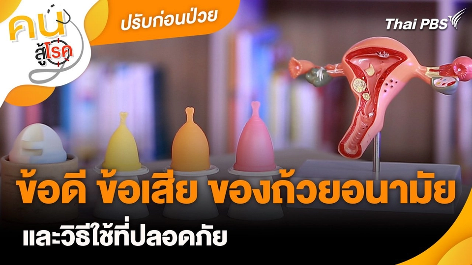ปรับก่อนป่วย : ข้อดีข้อเสียของถ้วยอนามัย และวิธีใช้อย่างปลอดภัย