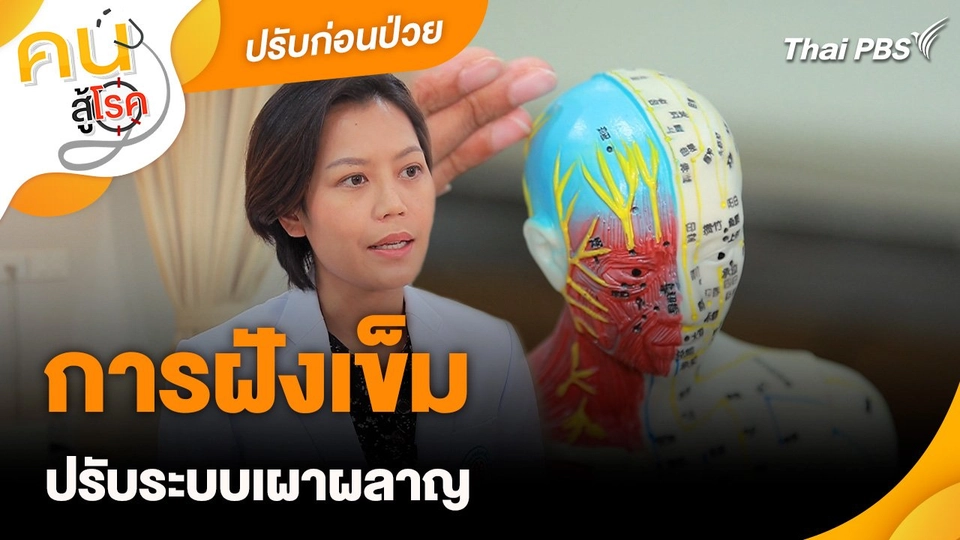 ปรับก่อนป่วย : การฝังเข็มปรับระบบเผาผลาญ