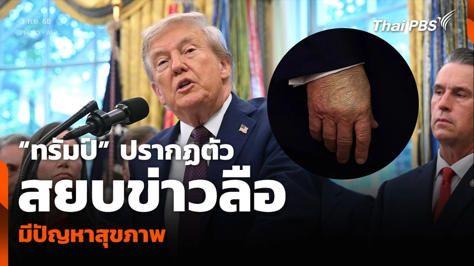 “ทรัมป์” ปรากฏตัวสยบข่าวลือ มีปัญหาสุขภาพ