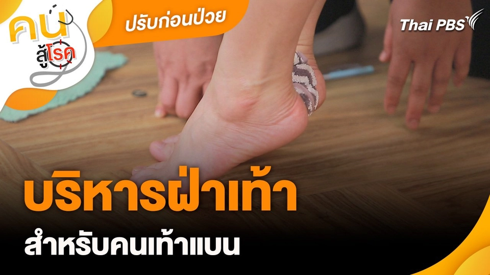 ปรับก่อนป่วย : บริหารฝ่าเท้าสำหรับคนเท้าแบน