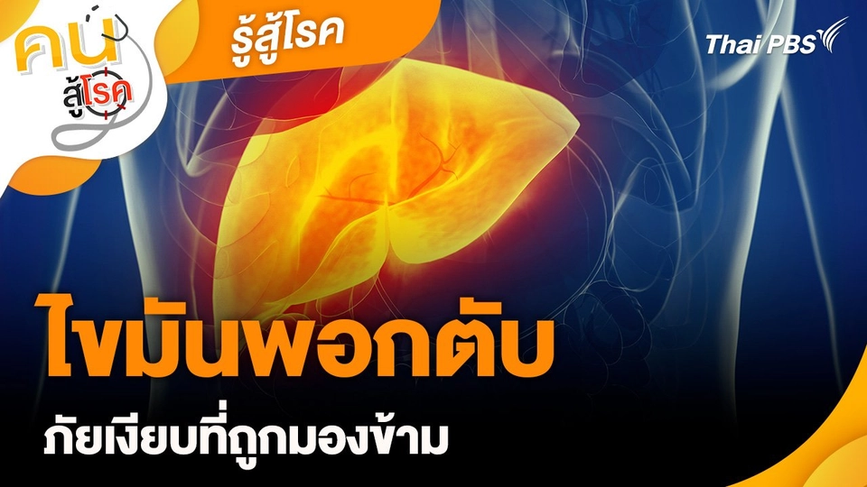 รู้สู้โรค : ไขมันพอกตับ ภัยเงียบที่ถูกมองข้าม